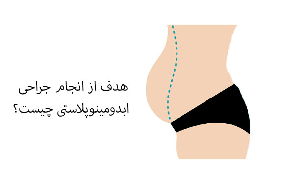 جراحی ابدومینوپلاستی