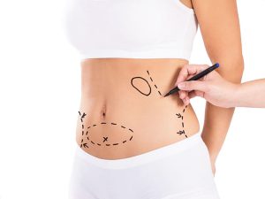 درباره جراحی لیپوساکشن
