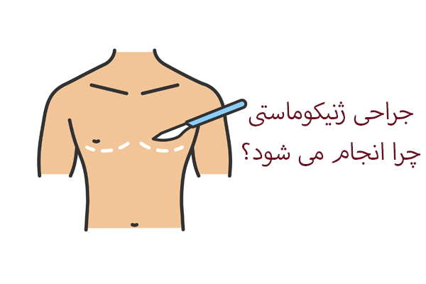 دریاره عمل ژنیکوماستی