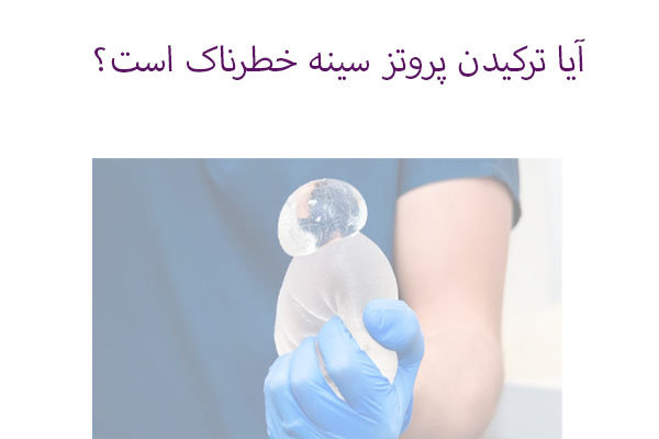 خطر ترکیدن پروتز سینه
