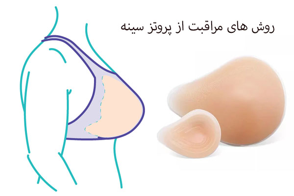 روش های مراقبت از پروتز سینه