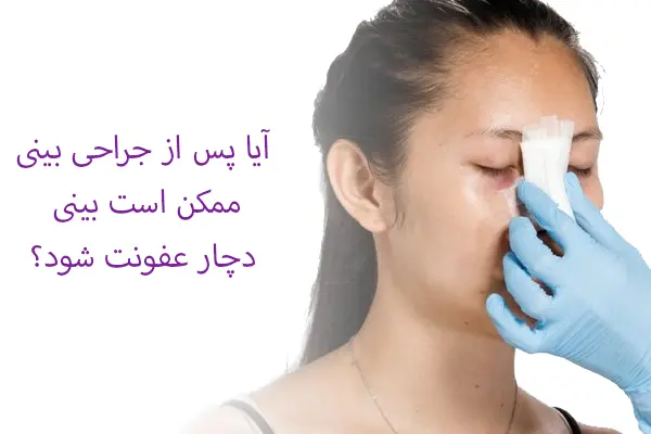 عفونت بعد از جراحی بینی