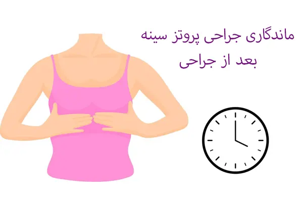 ماندگاری جراحی پروتز سینه بعد جراحی