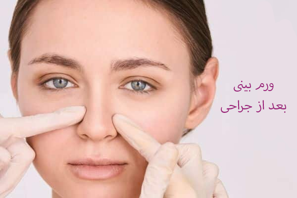 ورم بینی بعد از جراحی