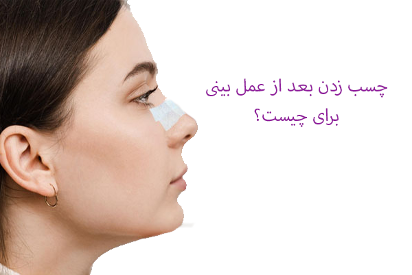 چسب زدن بعد از عمل بینی