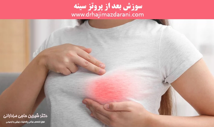 سوزش بعد از پروتز سینه