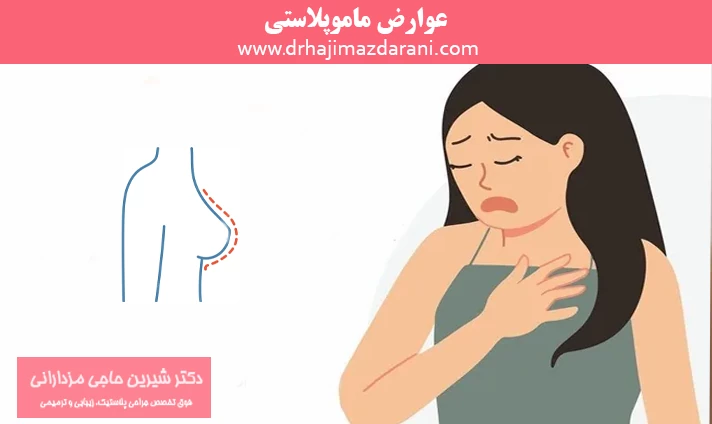 عوارض ماموپلاستی