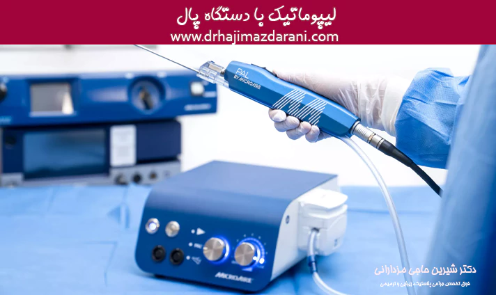 لیپوماتیک با دستگاه پال