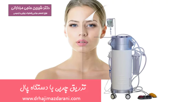 تزریق چربی با دستگاه پال