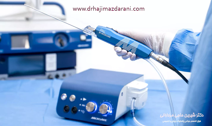 مزایا تزریق چربی با پال