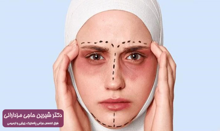 کبودی از عوارض جراحی لیفت صورت