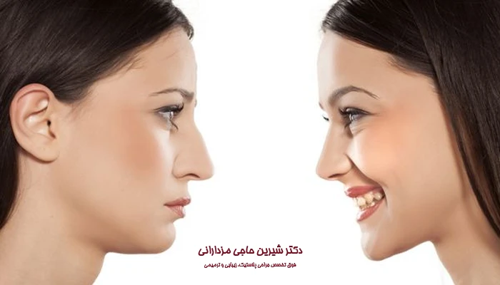عوامل موثر بر هزینه جراحی بینی در قم
