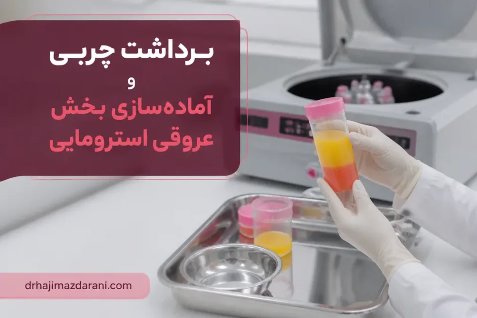 برداشت چربی و آمادهسازی بخش عروقی استرومایی — فرایند آمادهسازی SVF از بافت چربی با دستگاه آی سل در محیط استریل