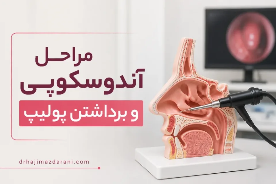 مراحل آندوسکوپی و برداشتن پولیپ — نمایش آموزشی ارزیابی آندوسکوپیک بینی و سینوس پیش از جراحی پولیپ