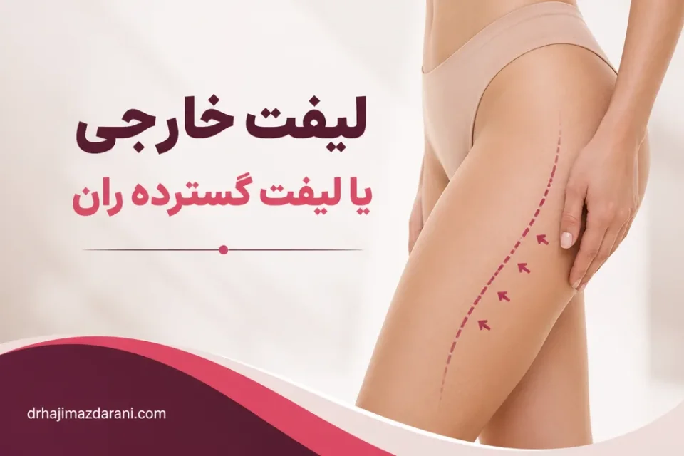 لیفت خارجی یا لیفت گسترده ران — مشاوره درباره محل برش در انواع لیفت ران