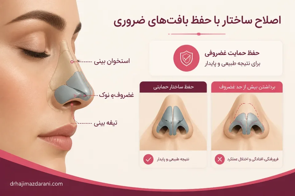 اصلاح ساختار با حفظ بافتهای ضروری — نمای آموزشی ساختار غضروفی بینی و حفظ حمایت آن در عمل بینی طبیعی